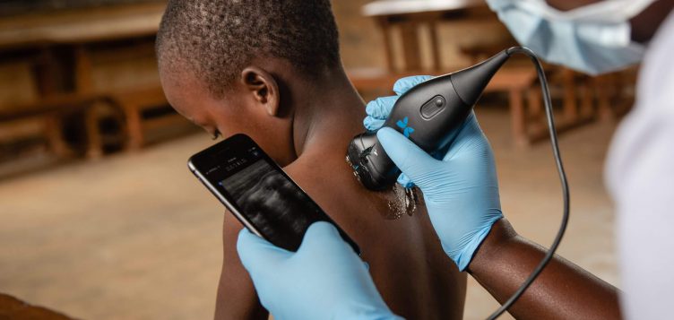 Abdul Latif Jameel Health et Butterfly Network concluent un partenariat de distribution stratégique pour apporter l’appareil d’échographie Butterfly iQ+ à un potentiel de 2 milliards de personnes au Moyen-Orient, en Afrique du Nord, en Turquie et en Inde